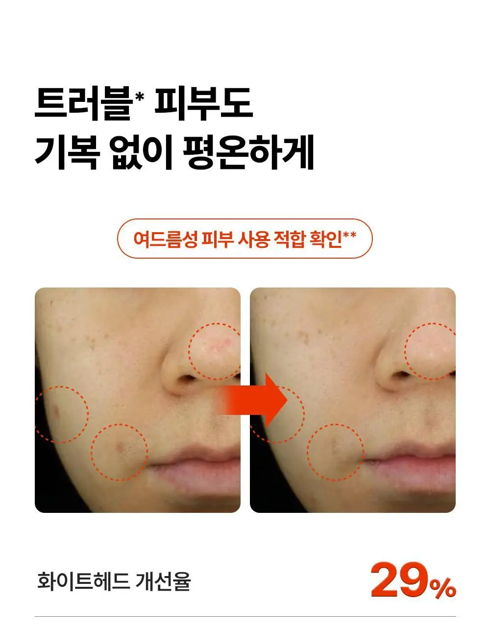 [장벽강화세럼] 퍼셀 20억/mL 픽셀바이옴 유산균 원액 20ml 기획 (+7ml) 상세페이지 19